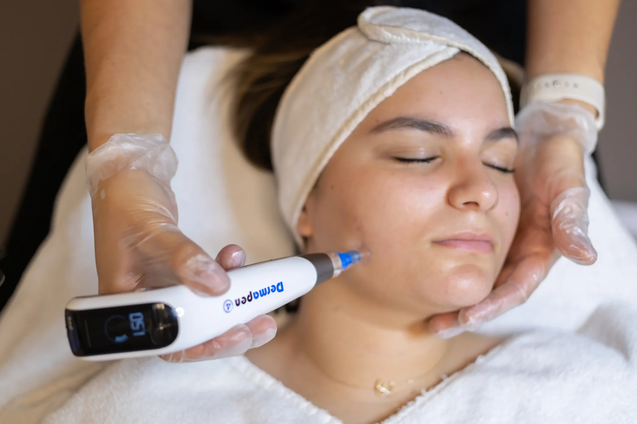 Microneedling Dermapen 4 Eindhoven voor huidverjonging en littekenbehandeling bij Polat Beauty
