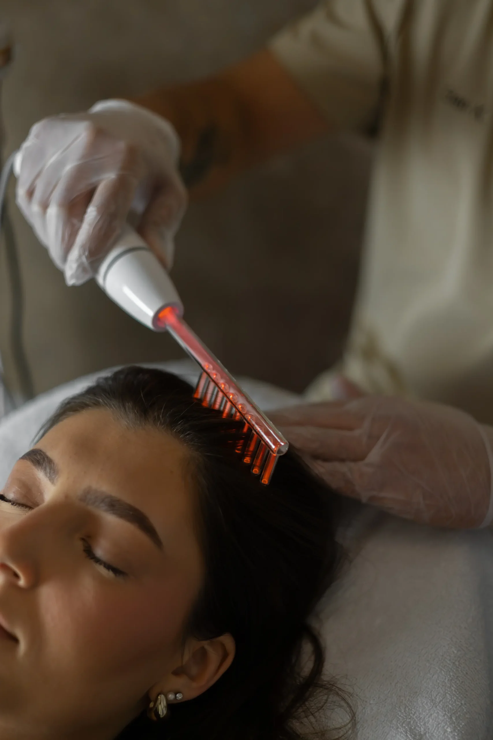 PRP behandeling Eindhoven met eigen bloedplaatjes voor huidverjonging en haargroei