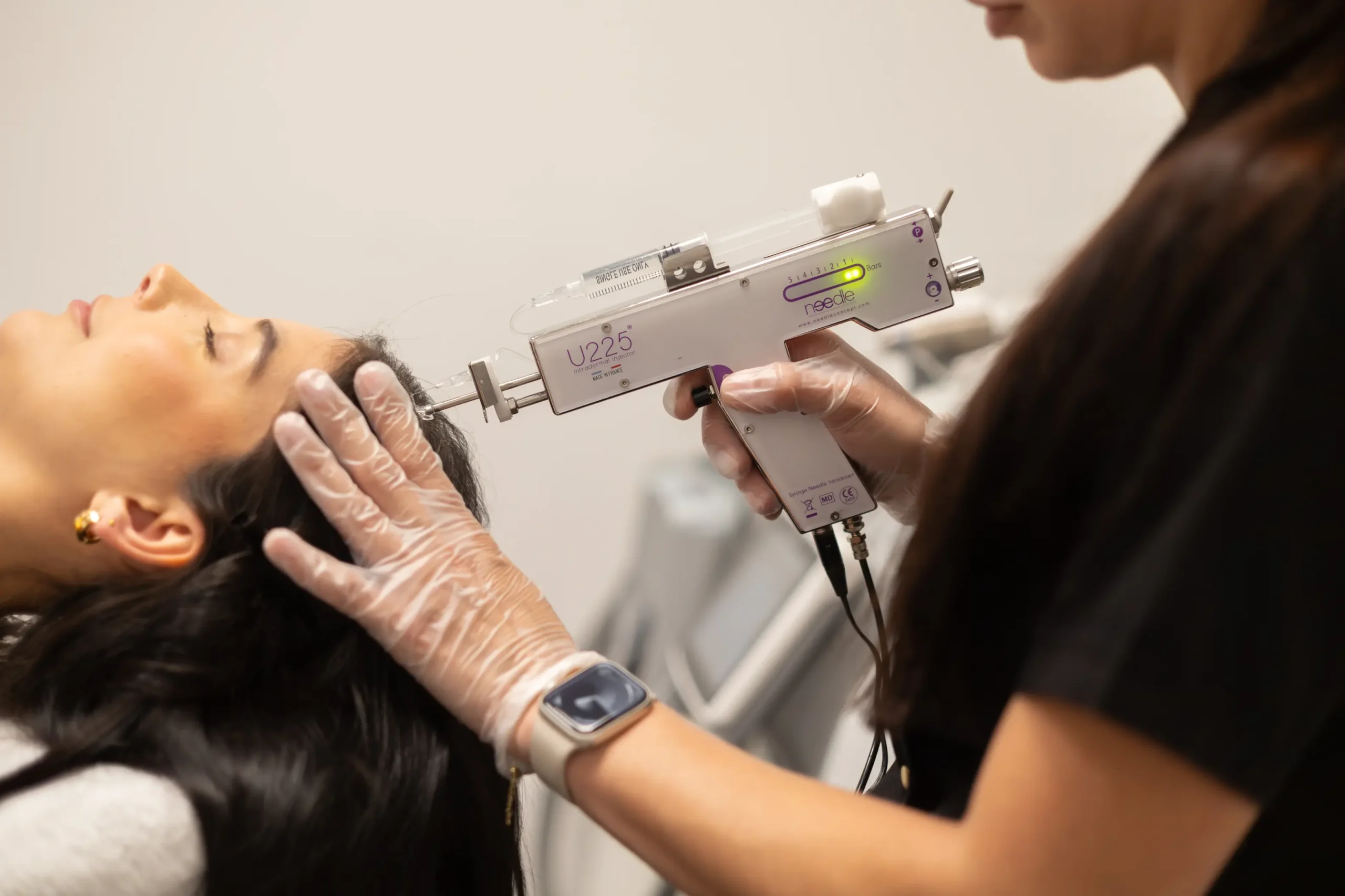 Hair XL behandeling bij Polat Beauty in Eindhoven