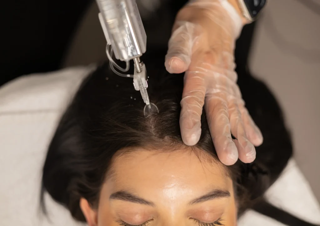 Hair XL behandeling Eindhoven voor haargroei en herstel bij Polat Beauty