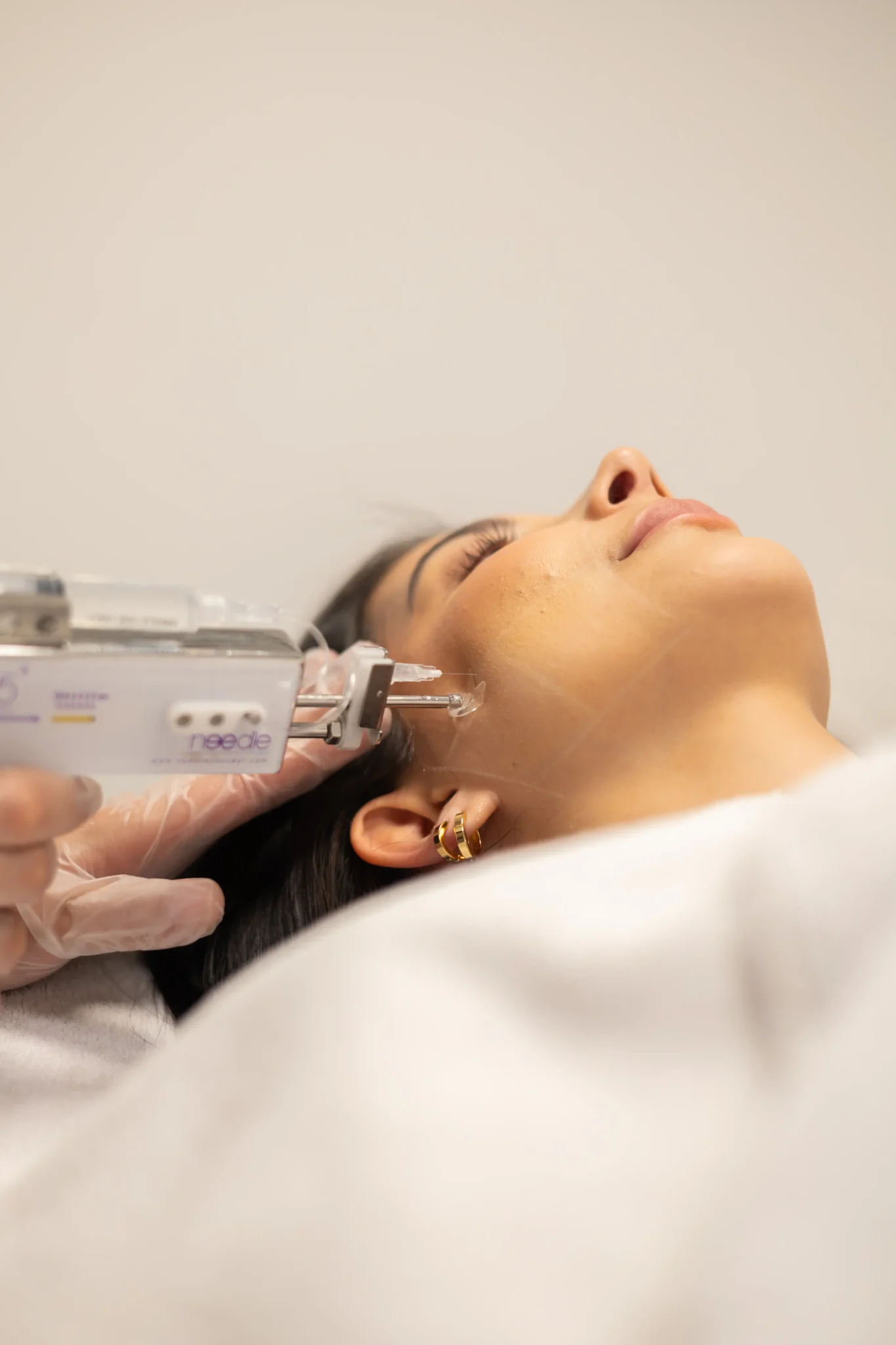 Skinbooster behandeling Eindhoven voor hydratatie en huidverjonging bij Polat Beauty