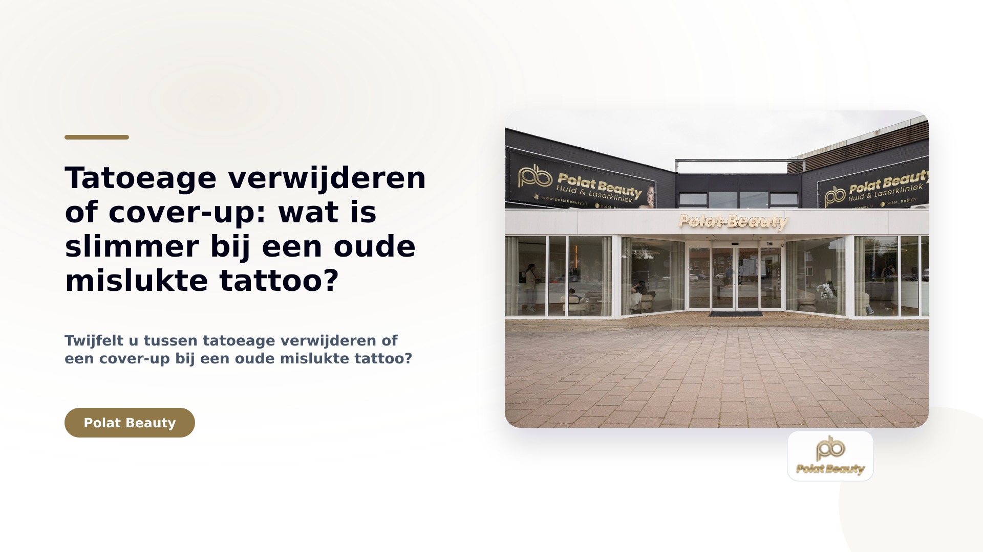 Tatoeage verwijderen of cover-up: wat is slimmer bij een oude mislukte tattoo?