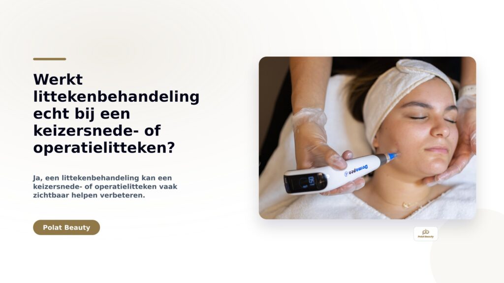 Werkt littekenbehandeling echt bij een keizersnede- of operatielitteken?