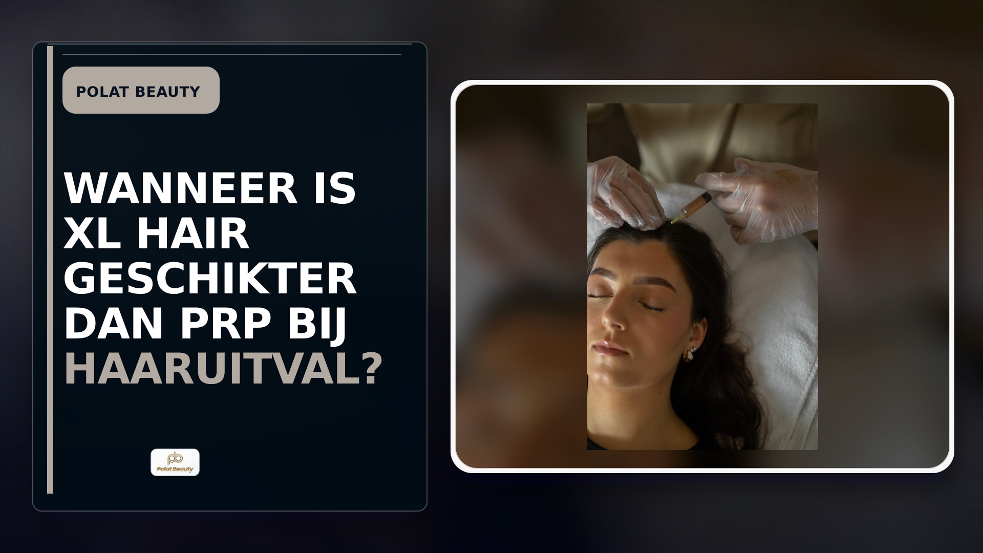 Wanneer is XL Hair geschikter dan PRP bij haaruitval?