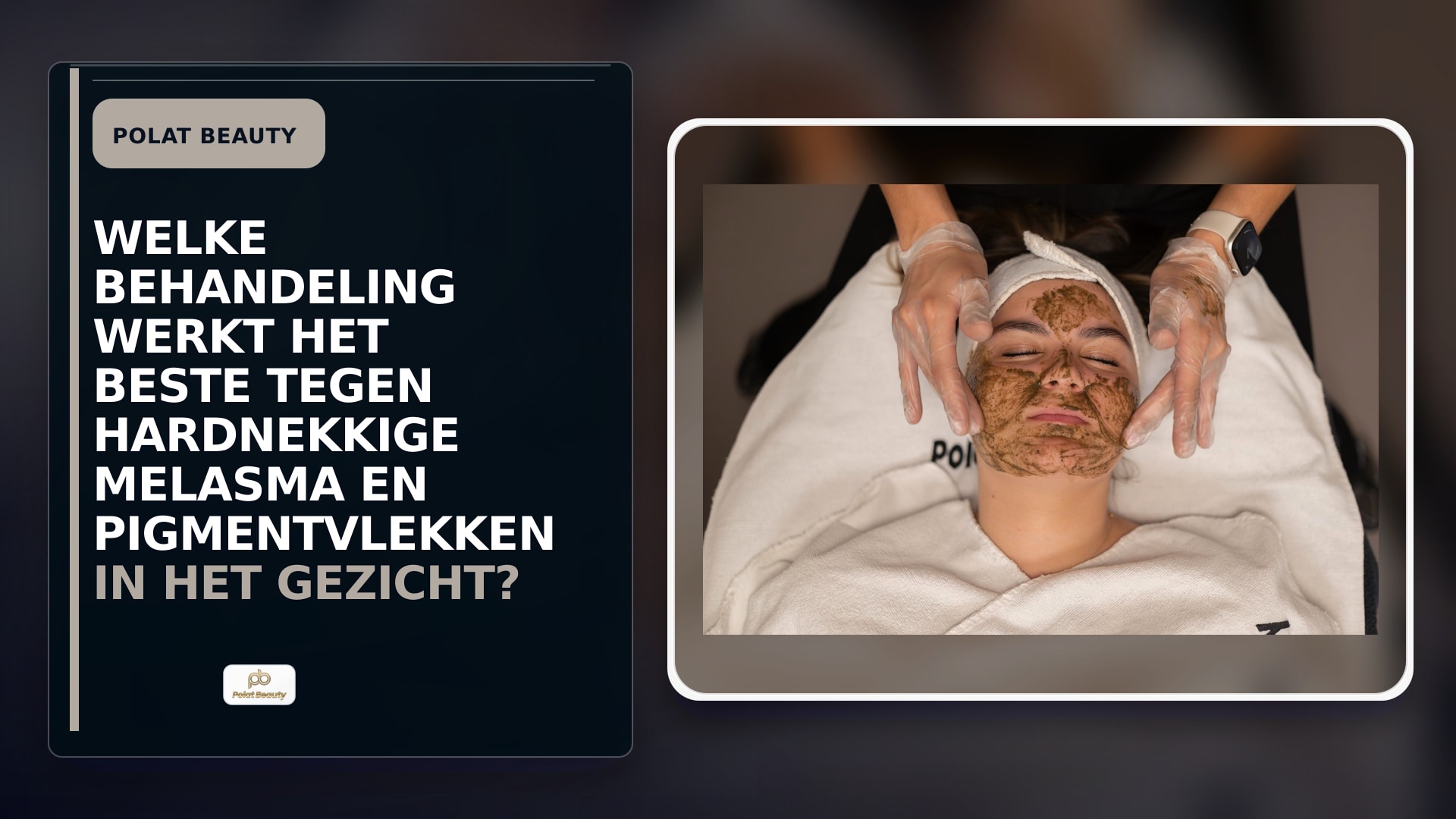 Welke behandeling werkt het beste tegen hardnekkige melasma en pigmentvlekken in het gezicht?