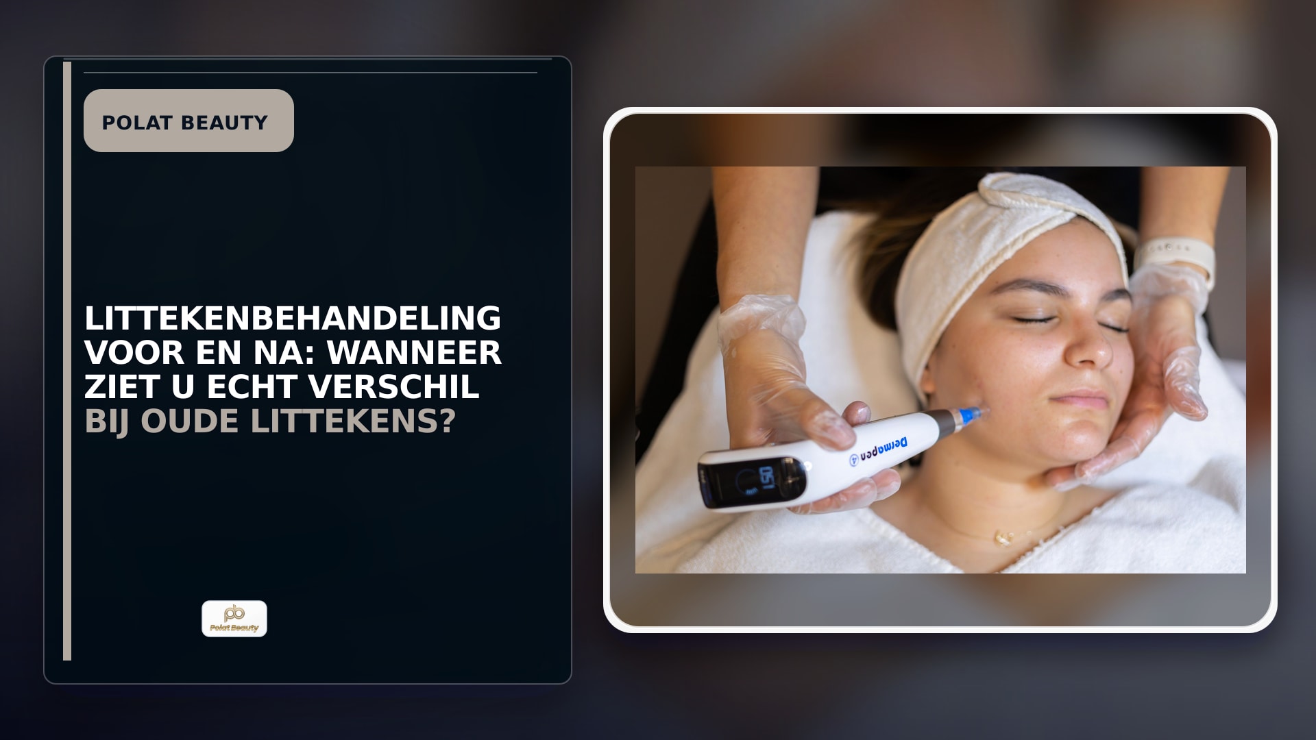 Littekenbehandeling voor en na: wanneer ziet u echt verschil bij oude littekens?
