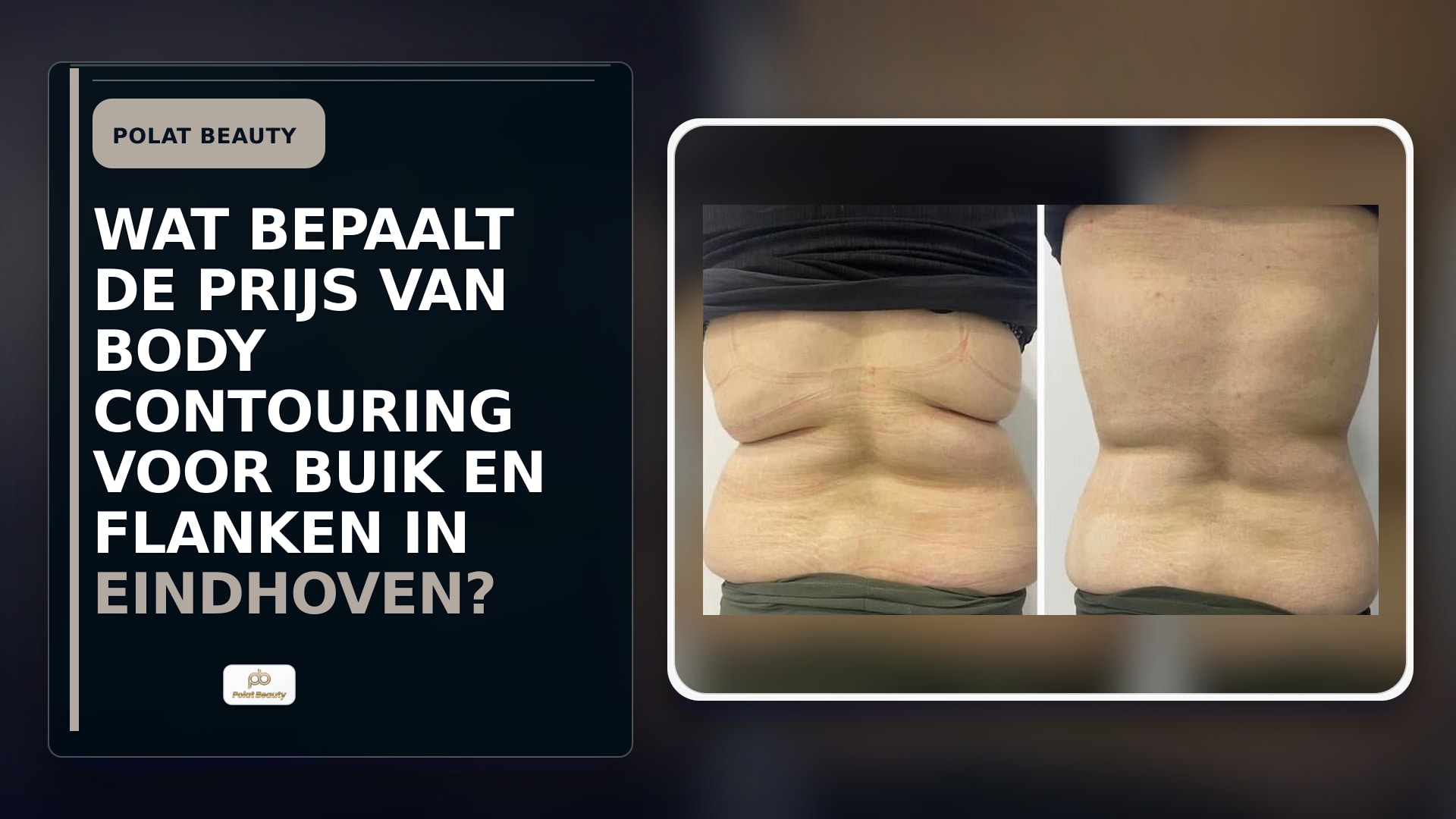 Wat bepaalt de prijs van body contouring voor buik en flanken in Eindhoven?
