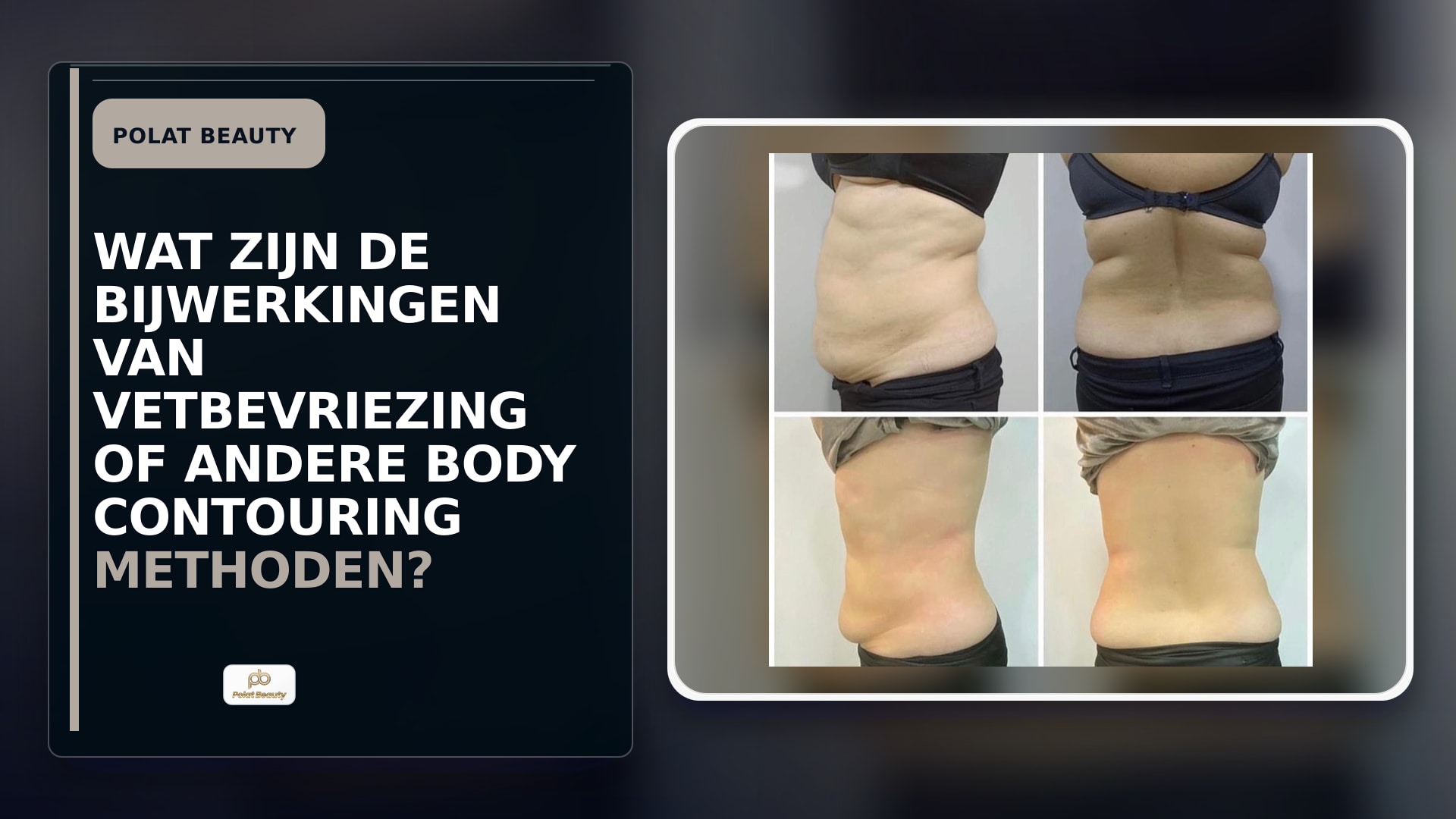 Wat zijn de bijwerkingen van vetbevriezing of andere body contouring methoden?
